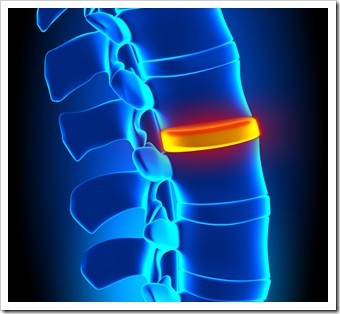 Herniated Disc and Back Pain Spartanburg SC